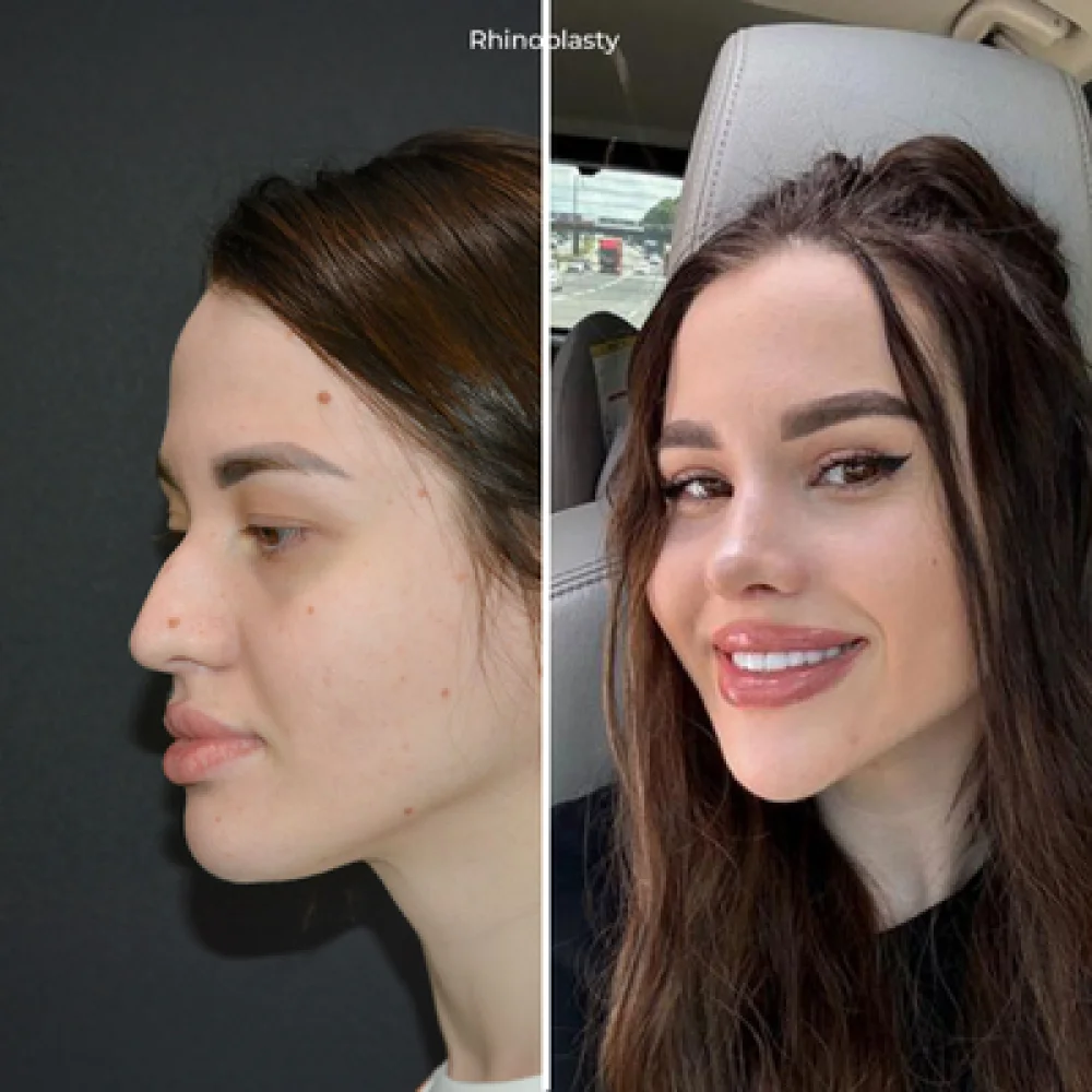 Most Preferred Plastic Surgeries by Age