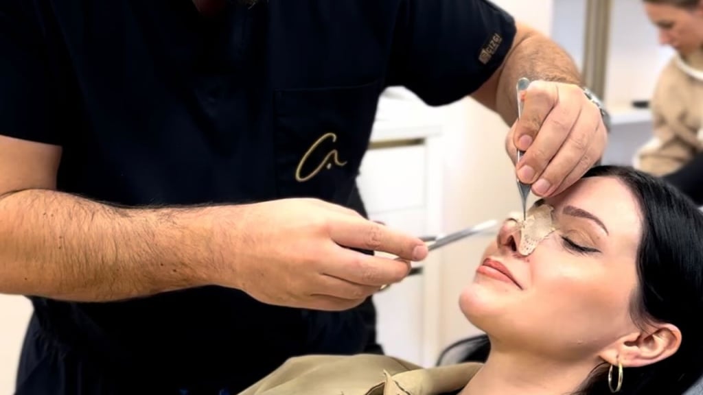 Botox oder Filler? Die Richtige Entscheidung zur Gesichtsverjüngung