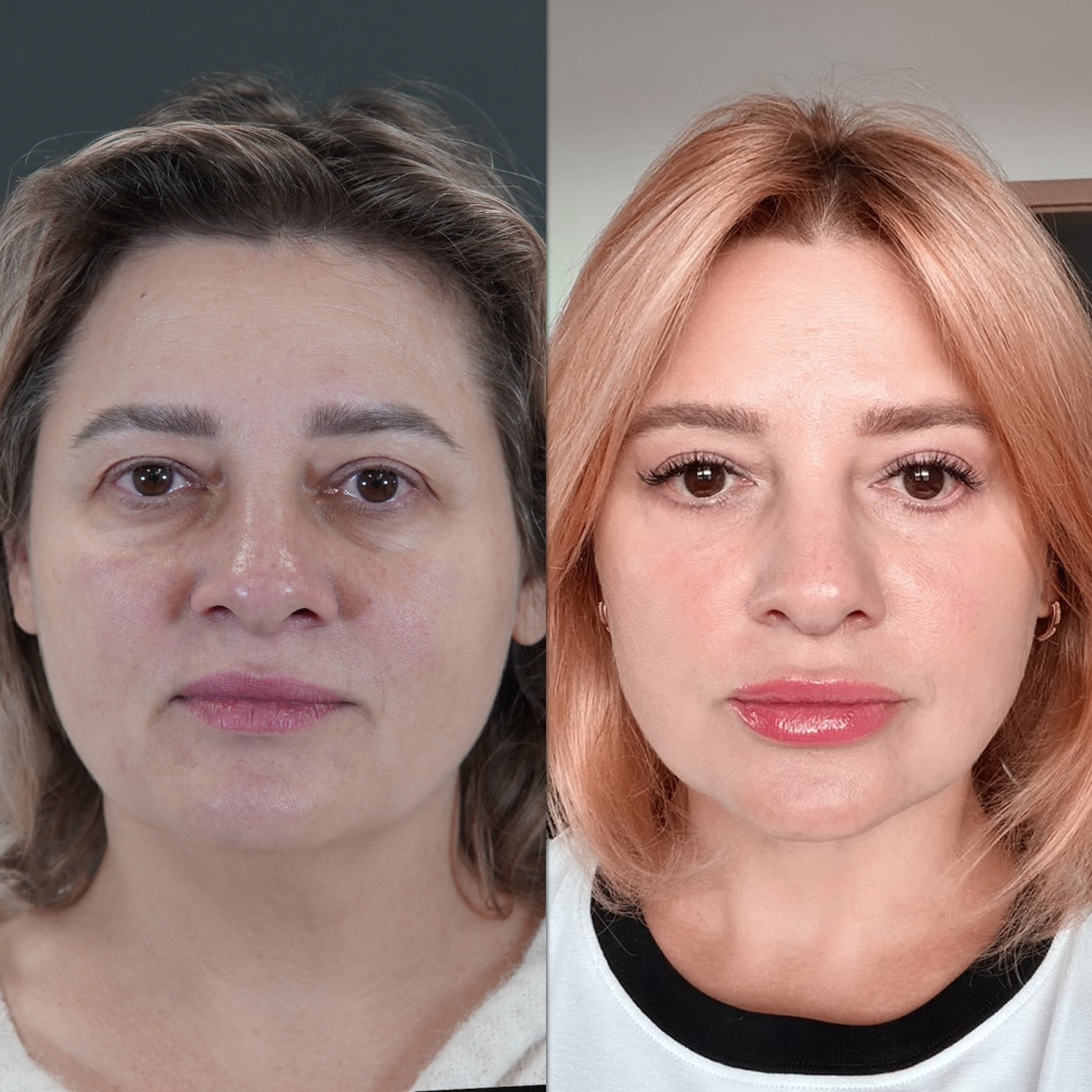 face20.jpg
