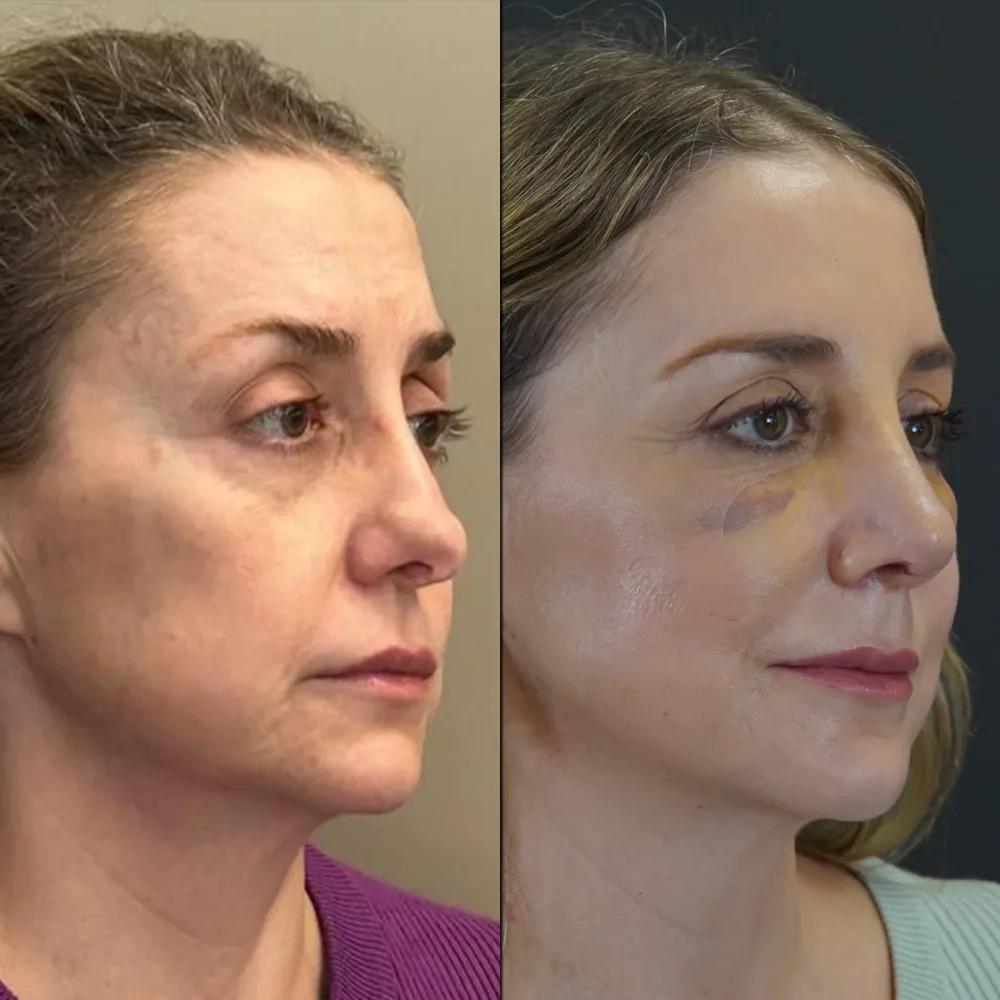 Plastic Surgery Prices in Turkey 2025: Comprehensive Guide for International Patients