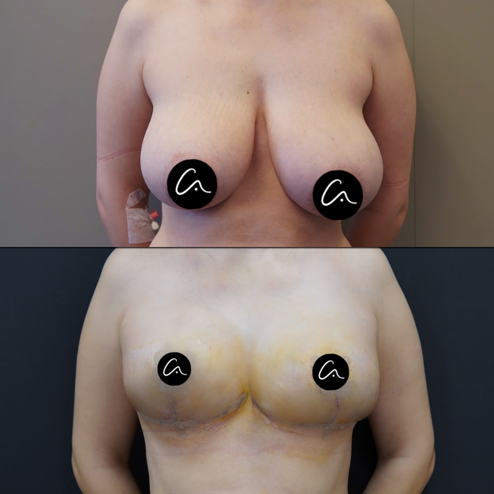Wie sollten die idealen Stirnbreitenmaße für Frauen und Männer sein?